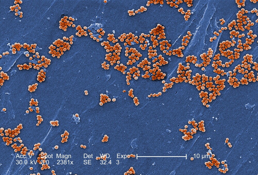 Staphylococcus aureus Bakterien, die eine Resistenz gegen das Antibiotikum Methicillin entwickelt haben, unter dem Rasterelektronenmikroskop (2381-fach vergrößert).